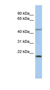KLF15 Antibody - KLF15 antibody Western blot of Fetal Spleen lysate. This image was taken for the unconjugated form of this product. Other forms have not been tested.
