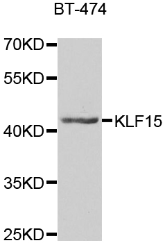 KLF15 Antibody - Western blot analysis of extracts of BT-474 cells.