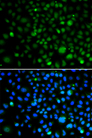 KLF15 Antibody - Immunofluorescence analysis of A549 cells.
