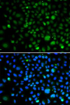 KLF15 Antibody - Immunofluorescence analysis of A549 cells.