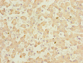 KLF15 Antibody - Immunohistochemistry of paraffin-embedded human liver tissue at dilution 1:100