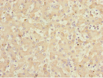 KLF15 Antibody - Immunohistochemistry of paraffin-embedded human liver tissue at dilution 1:100