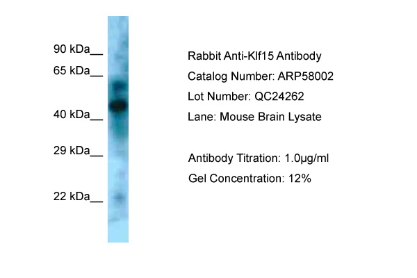 KLF15 Antibody -  This image was taken for the unconjugated form of this product. Other forms have not been tested.