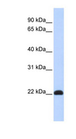 KLF16 Antibody - KLF16 antibody Western blot of Fetal Muscle lysate. This image was taken for the unconjugated form of this product. Other forms have not been tested.