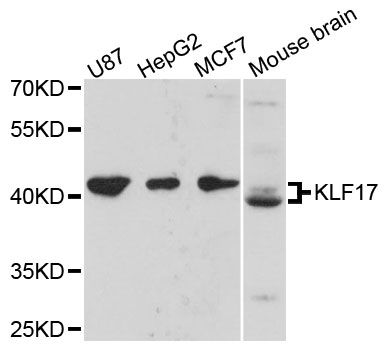 KLF17 Antibody - Western blot analysis of extracts of various cell lines, using KLF17 antibody at 1:3000 dilution. The secondary antibody used was an HRP Goat Anti-Rabbit IgG (H+L) at 1:10000 dilution. Lysates were loaded 25ug per lane and 3% nonfat dry milk in TBST was used for blocking. An ECL Kit was used for detection and the exposure time was 30s.