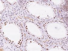 KLF17 Antibody - Immunochemical staining of human KLF17 in human testis with rabbit polyclonal antibody at 1:1000 dilution, formalin-fixed paraffin embedded sections.