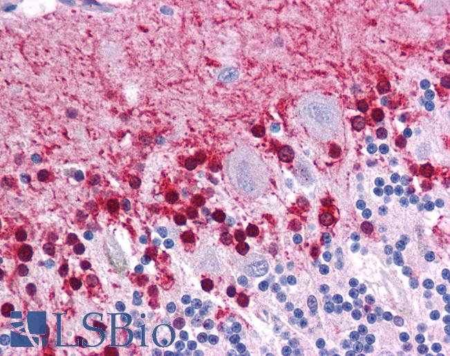 KLF2 Antibody - Anti-KLF2 antibody IHC of human brain, cerebellum. Immunohistochemistry of formalin-fixed, paraffin-embedded tissue after heat-induced antigen retrieval. Antibody concentration 5 ug/ml.  This image was taken for the unconjugated form of this product. Other forms have not been tested.