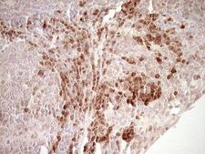 KLF2 Antibody - Immunohistochemical staining of paraffin-embedded Human tonsil within the normal limits using anti-KLF2 mouse monoclonal antibody. (Heat-induced epitope retrieval by 1 mM EDTA in 10mM Tris, pH8.5, 120C for 3min,