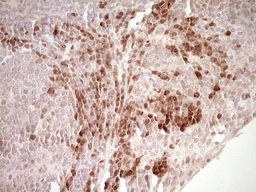 KLF2 Antibody - IHC of paraffin-embedded Human tonsil using anti-KLF2 mouse monoclonal antibody. (Heat-induced epitope retrieval by 1 mM EDTA in 10mM Tris, pH8.5, 120°C for 3min).