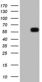 KLF2 Antibody - HEK293T cells were transfected with the pCMV6-ENTRY control. (Left lane) or pCMV6-ENTRY KLF2. (Right lane) cDNA for 48 hrs and lysed. Equivalent amounts of cell lysates. (5 ug per lane) were separated by SDS-PAGE and immunoblotted with anti-KLF2.