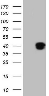 KLF2 Antibody - HEK293T cells were transfected with the pCMV6-ENTRY control. (Left lane) or pCMV6-ENTRY KLF2. (Right lane) cDNA for 48 hrs and lysed. Equivalent amounts of cell lysates. (5 ug per lane) were separated by SDS-PAGE and immunoblotted with anti-KLF2.