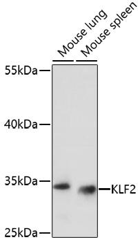 KLF2 Antibody - Western blot analysis of extracts of various cell lines using KLF2 Polyclonal Antibody at dilution of 1:1000.