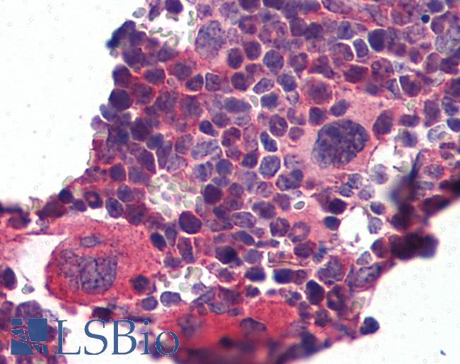 KLF2 Antibody - Anti-KLF2 antibody IHC of mouse lymphoid tissue. Immunohistochemistry of formalin-fixed, paraffin-embedded tissue after heat-induced antigen retrieval. Antibody concentration 5 ug/ml.  This image was taken for the unconjugated form of this product. Other forms have not been tested.