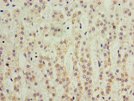 KLF3 Antibody - Immunohistochemistry of paraffin-embedded human adrenal gland using antibody at 1:100 dilution.
