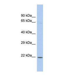 KLF3 Antibody - Western blot of Human THP-1. KLF3 antibody dilution 1.0 ug/ml.  This image was taken for the unconjugated form of this product. Other forms have not been tested.
