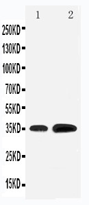 KLF3 Antibody - WB of KLF3 antibody. All lanes: Anti-KLF3 at 0.5ug/ml. Lane 1: Rat Testis Tissue Lysate at 40ug. Lane 2: HELA Whole Cell Lysate at 40ug. Predicted bind size: 35KD. Observed bind size: 35KD.