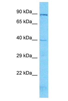 KLF3 Antibody - KLF3 antibody Western Blot of 721_B. Antibody dilution: 1 ug/ml.  This image was taken for the unconjugated form of this product. Other forms have not been tested.
