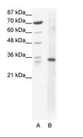KLF3 Antibody - A: Marker, B: HepG2 Cell Lysate.  This image was taken for the unconjugated form of this product. Other forms have not been tested.