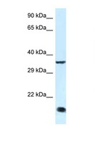 KLF3 Antibody - KLF3 antibody Western blot of Rat Muscle lysate. Antibody concentration 1 ug/ml.  This image was taken for the unconjugated form of this product. Other forms have not been tested.