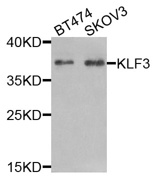 KLF3 Antibody - Western blot analysis of extracts of various cells.