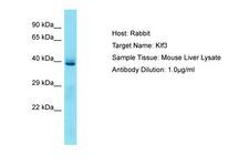 KLF3 Antibody -  This image was taken for the unconjugated form of this product. Other forms have not been tested.