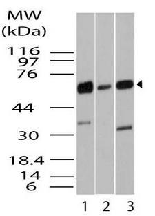 KLF4 Antibody - Fig-1: Western blot analysis of KLF4/GKLF. Anti- KLF4/GKLF antibody was used at 2 µg/ml on 1) HCT-116, 2) Hela and 3) A549 lysates.