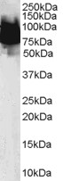 KLF4 Antibody - Antibody (0.1 ug/ml) staining of Human Duodenum lysate (35 ug protein in RIPA buffer). Primary incubation was 1 hour. Detected by chemiluminescence.