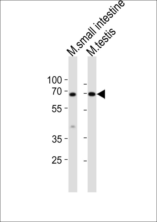 KLF4 Antibody - Western blot of lysates from mouse small intestine, mouse testis tissue lysate (from left to right), using Klf4 antibody diluted at 1:1000 at each lane. A goat anti-rabbit IgG H&L (HRP) at 1:10000 dilution was used as the secondary antibody. Lysates at 20 ug per lane.