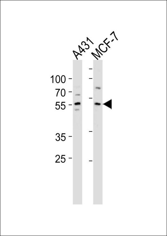 KLF4 Antibody - KLF4 Antibody western blot of A431,MCF-7 cell line lysates (35 ug/lane). The KLF4 antibody detected the KLF4 protein (arrow).