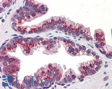 KLF4 Antibody - Anti-KLF4 antibody IHC of human prostate. Immunohistochemistry of formalin-fixed, paraffin-embedded tissue after heat-induced antigen retrieval. Antibody concentration 5 ug/ml.  This image was taken for the unconjugated form of this product. Other forms have not been tested.
