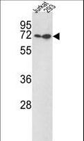 KLF4 Antibody - Western blot of KLF4 Antibody (N-term C74) in Jurkat,293 cell line lysates (35 ug/lane). KLF4 (arrow) was detected using the purified antibody.