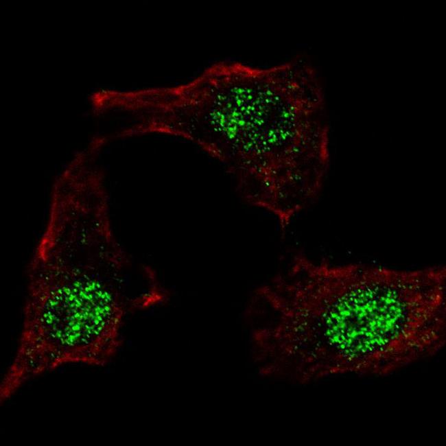 KLF4 Antibody - Fluorescent confocal image of HeLa cells stained KLF4 (N-term C74) antibody. HeLa cells were fixed with 4% PFA (20 min), permeabilized with Triton X-100 (0.2%, 30 min), then incubated KLF4 (N-term C74) primary antibody (1:100, 2 h at room temperature). For secondary antibody, Alexa Fluor 488 conjugated donkey anti-rabbit antibody (green) was used (1:1000, 1h). Cytoplasmic actin was counterstained with Alexa Fluor 555 (red) conjugated Phalloidin (5.25 mu M, 25 min). KLF4 immunoreactivity is localized to the nuclei in HeLa cells.