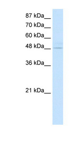 KLF4 Antibody - KLF4 antibody Western blot of Transfected 293T cell lysate. This image was taken for the unconjugated form of this product. Other forms have not been tested.
