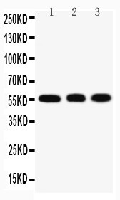 KLF4 Antibody - WB of KLF4 antibody. Lane 1: HELA Cell Lysate. Lane 2: A549 Cell Lysate. Lane 3: U20S Cell Lysate.
