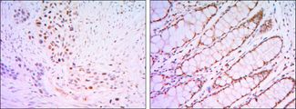 KLF4 Antibody - KLF4 Antibody in Immunohistochemistry (IHC)