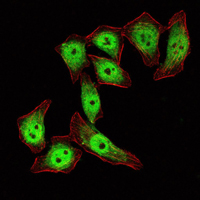 KLF4 Antibody - Immunofluorescence of ECA109 cells using KLF4 mouse monoclonal antibody (green). Red: Actin filaments have been labeled with Alexa Fluor-555 phalloidin.