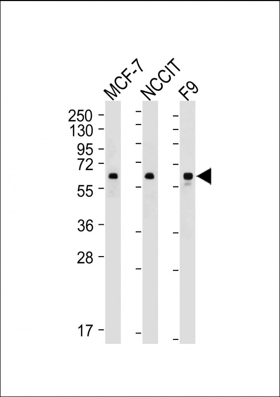 KLF4 Antibody - All lanes: Anti-KLF4 Antibody at 1:500-1:1000 dilution Lane 1: MCF-7 whole cell lysate Lane 2: NCCIT whole cell lysate Lane 3: F9 whole cell lysate Lysates/proteins at 20 µg per lane. Secondary Goat Anti-mouse IgG, (H+L), Peroxidase conjugated at 1/10000 dilution. Predicted band size: 55 kDa Blocking/Dilution buffer: 5% NFDM/TBST.