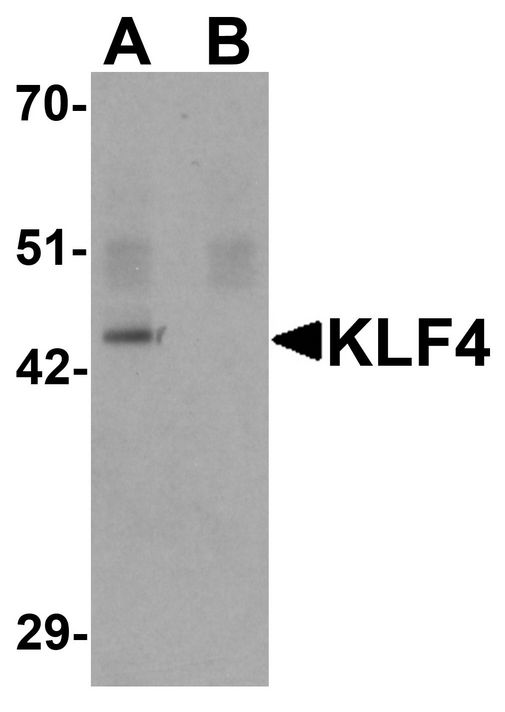 KLF4 Antibody - Western blot analysis of KLF4 in mouse liver tissue lysate with KLF4 antibody at 1 ug/ml in (A) the absence and (B) the presence of blocking peptide.