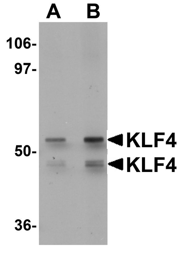 KLF4 Antibody - Western blot analysis of KLF4 in human liver tissue lysate with KLF4 antibody at (A) 1 and (B) 2 ug/ml.