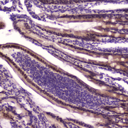 KLF4 Antibody - IHC analysis of KLF4 using anti-KLF4 antibody. KLF4 was detected in paraffin-embedded section of rat small intestine tissue. Heat mediated antigen retrieval was performed in citrate buffer (pH6, epitope retrieval solution) for 20 mins. The tissue section was blocked with 10% goat serum. The tissue section was then incubated with 2?g/ml rabbit anti-KLF4 Antibody overnight at 4?C. Biotinylated goat anti-rabbit IgG was used as secondary antibody and incubated for 30 minutes at 37?C. The tissue section was developed using Strepavidin-Biotin-Complex (SABC) with DAB as the chromogen.