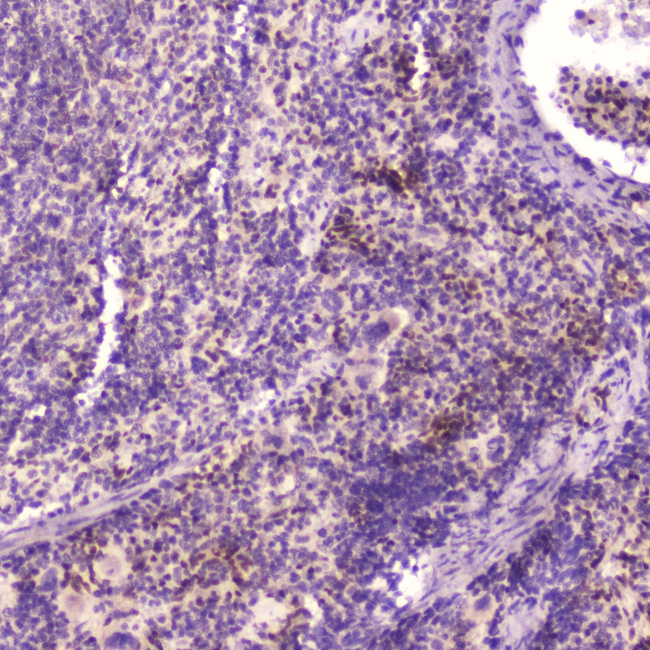 KLF4 Antibody - IHC analysis of KLF4 using anti-KLF4 antibody. KLF4 was detected in paraffin-embedded section of mouse spleen tissue . Heat mediated antigen retrieval was performed in citrate buffer (pH6, epitope retrieval solution) for 20 mins. The tissue section was blocked with 10% goat serum. The tissue section was then incubated with 2?g/ml rabbit anti-KLF4 Antibody overnight at 4?C. Biotinylated goat anti-rabbit IgG was used as secondary antibody and incubated for 30 minutes at 37?C. The tissue section was developed using Strepavidin-Biotin-Complex (SABC) with DAB as the chromogen.
