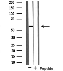 KLF4 Antibody - Western blot analysis on HeLa cell lysates using KLF4 antibody