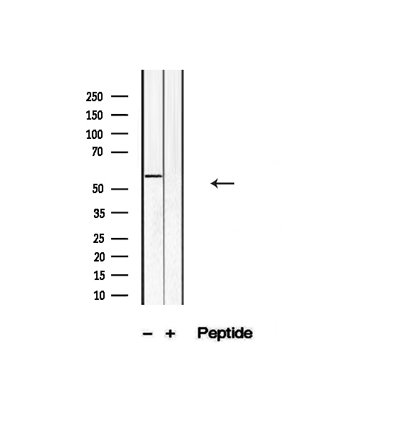 KLF4 Antibody - Western blot analysis of extracts of HT-1080 Jurkat cells using KLF4 antibody.