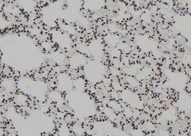 KLF4 Antibody - 1:100 staining rat lung tissue by IHC-P. The sample was formaldehyde fixed and a heat mediated antigen retrieval step in citrate buffer was performed. The sample was then blocked and incubated with the antibody for 1.5 hours at 22°C. An HRP conjugated goat anti-rabbit antibody was used as the secondary.