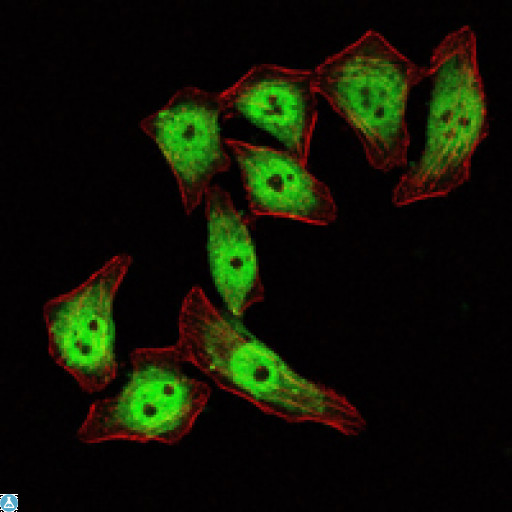 KLF4 Antibody - Immunofluorescence (IF) analysis of ECA109 cells using GKLF Monoclonal Antibody (green). Red: Actin filaments have been labeled with Alexa Fluor-555 phalloidin.