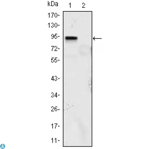 KLF4 Antibody - Immunohistochemistry (IHC) analysis of paraffin-embedded Lung Cancer Tissues (left) and human rectum tissues (right) with DAB staining using GKLF Monoclonal Antibody.