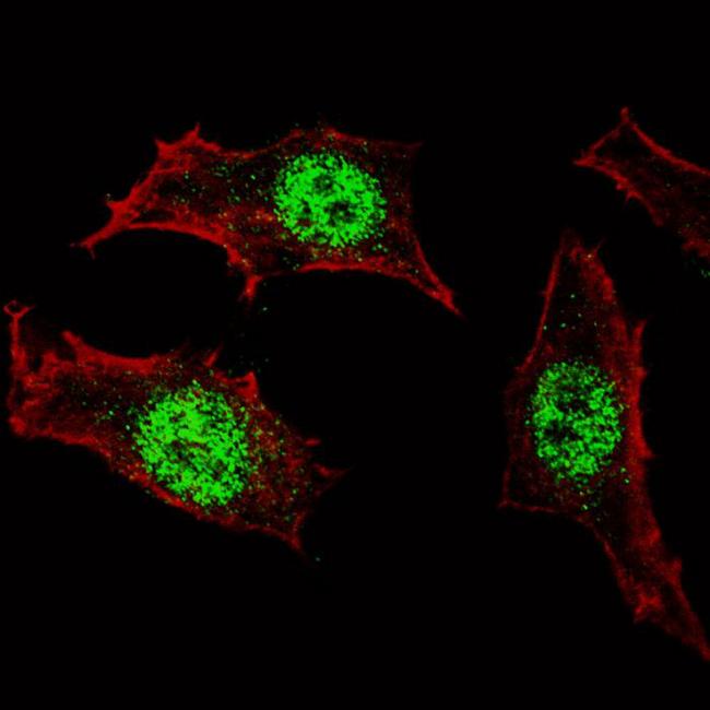 KLF4 Antibody - Fluorescent confocal image of HeLa cells stained KLF4 antibody. HeLa cells were fixed with 4% PFA (20 min), permeabilized with Triton X-100 (0.2%, 30 min), then incubated KLF4 primary antibody (1:100, 2 h at room temperature). For secondary antibody, Alexa Fluor 488 conjugated donkey anti-rabbit antibody (green) was used (1:1000, 1h). Cytoplasmic actin was counterstained with Alexa Fluor 555 (red) conjugated Phalloidin (5.25 mu M, 25 min). KLF4 immunoreactivity is localized specifically to the nuclei in HeLa cells.