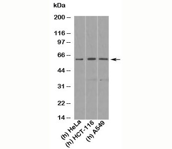 KLF4 Antibody - KLF4 antibody western blot of human samples
