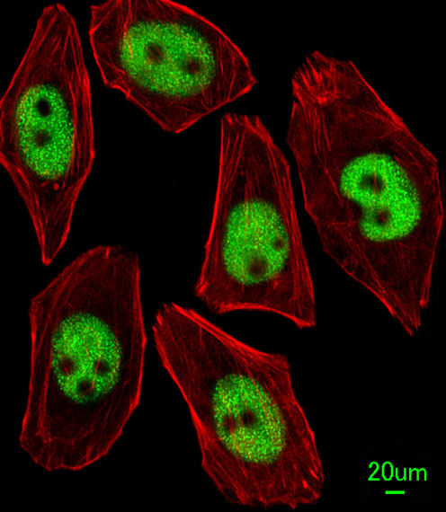 KLF4 Antibody - Immunofluorescence of U251 cells, using KLF4 Antibody. Antibody was diluted at 1:25 dilution. Alexa Fluor 488-conjugated goat anti-rabbit lgG at 1:400 dilution was used as the secondary antibody (green). Cytoplasmic actin was counterstained with Dylight Fluor 554 (red) conjugated Phalloidin (red).