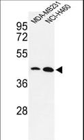 KLF4 Antibody - Western blot of KLF4-S457 in MDA-MB231, NCI-H460 cell line lysates (35 ug/lane). KLF4 (arrow) was detected using the purified antibody.